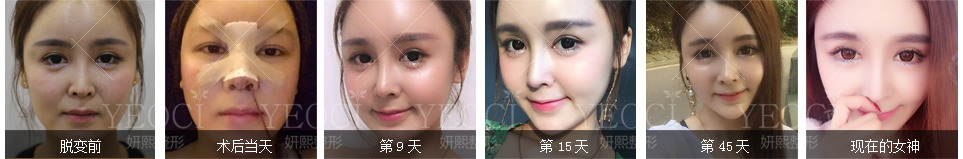 改變一點點，丑小鴨變天鵝