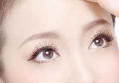 切開(kāi)雙眼皮術(shù)后需要注意哪些東西？