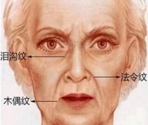 整形術(shù)后你要如何調(diào)整心態(tài)